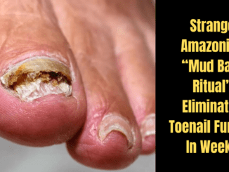 Strange Amazonian Mud Bath Ritual Eliminates Toenail Fungus In Weeks