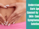 Understanding Dark Spots Caused By Leaky Skin: Causes, Symptoms, and Solutions